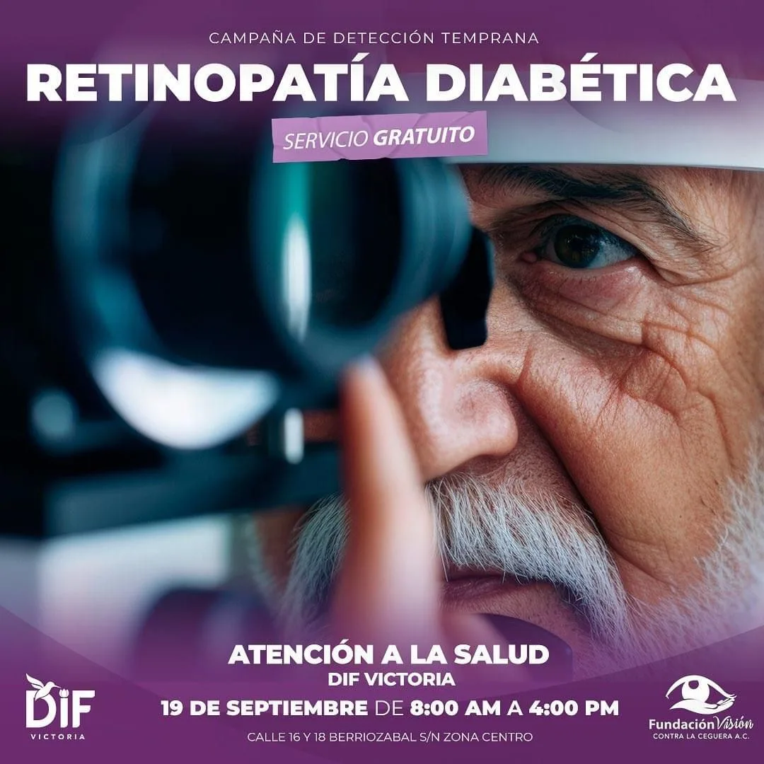 DIF Victoria lanza campaña gratuita para la Detección Temprana de Retinopatía Diabética